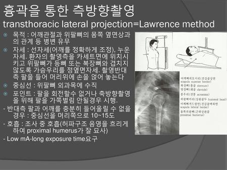 흉곽을 통한 측방향촬영 transthoracic lateral projection=Lawrence method