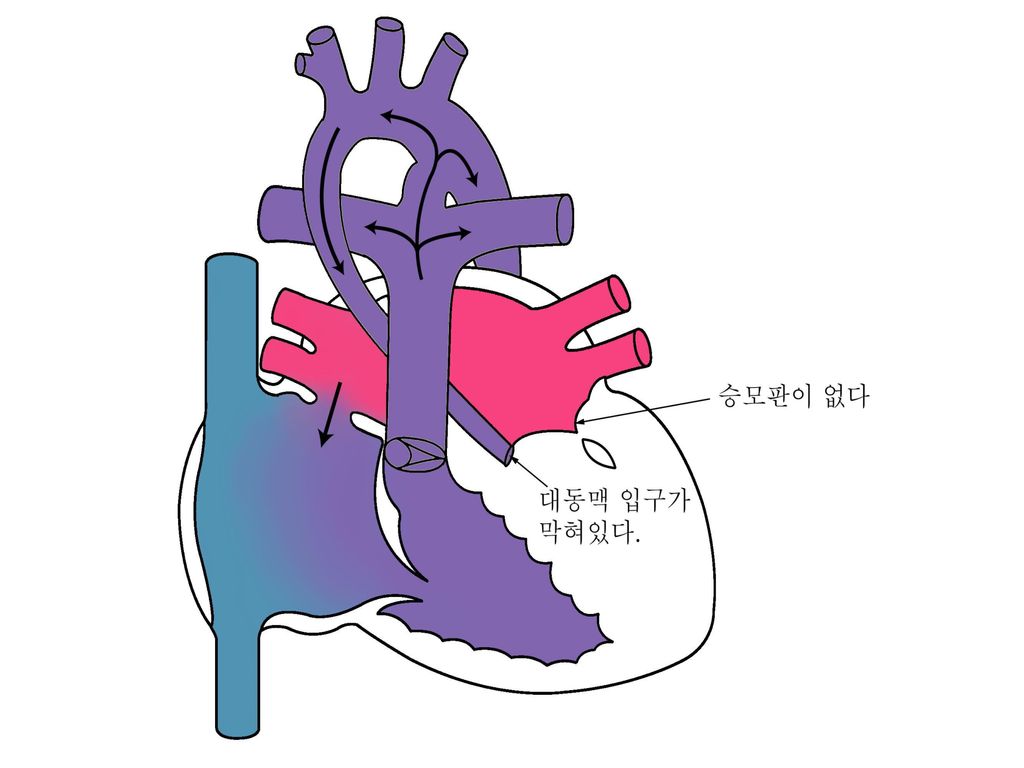 8ìž¥ ì„ ì²œì„± ì‹¬ìž¥ë³' ê°€ì²œì˜ëŒ€ ì‚°ë¶€ì¸ê³¼ ê¹€ ê´'ì¤€ Ppt Download