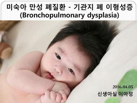 미숙아 만성 폐질환 - 기관지 폐 이형성증 (Bronchopulmonary dysplasia)