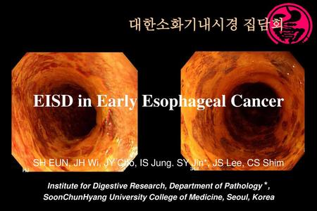 EISD in Early Esophageal Cancer