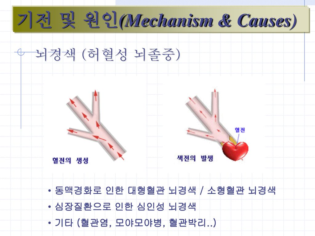 기전 및 원인(Mechanism & Causes)