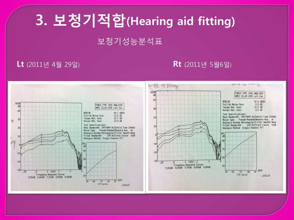 3. 보청기적합(Hearing aid fitting)