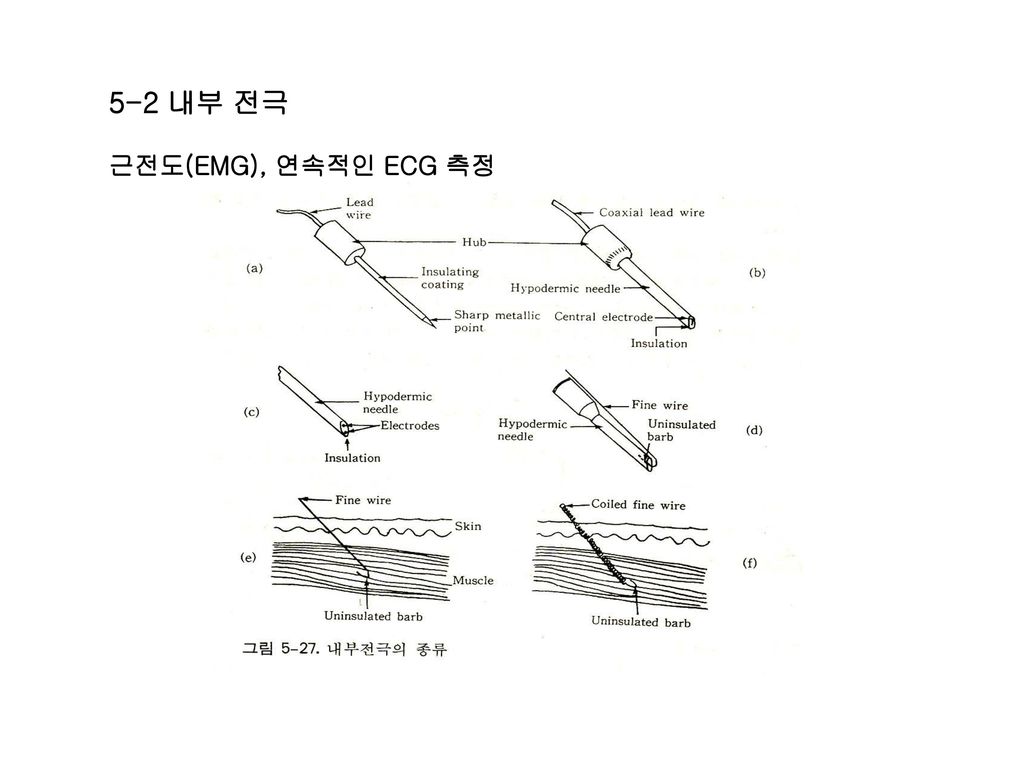 5-2 내부 전극 근전도(EMG), 연속적인 ECG 측정