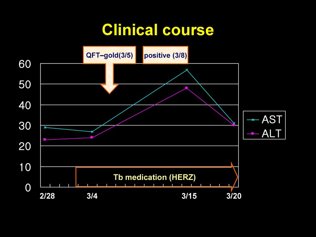 Clinical course Tb medication (HERZ) 2/28 3/4 3/15 3/20 QFT–gold(3/5)