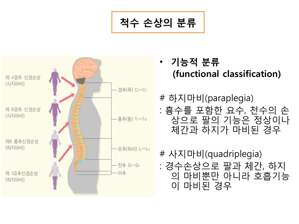 척수 손상의 분류 기능적 분류 (functional classification) # 하지마비(paraplegia)