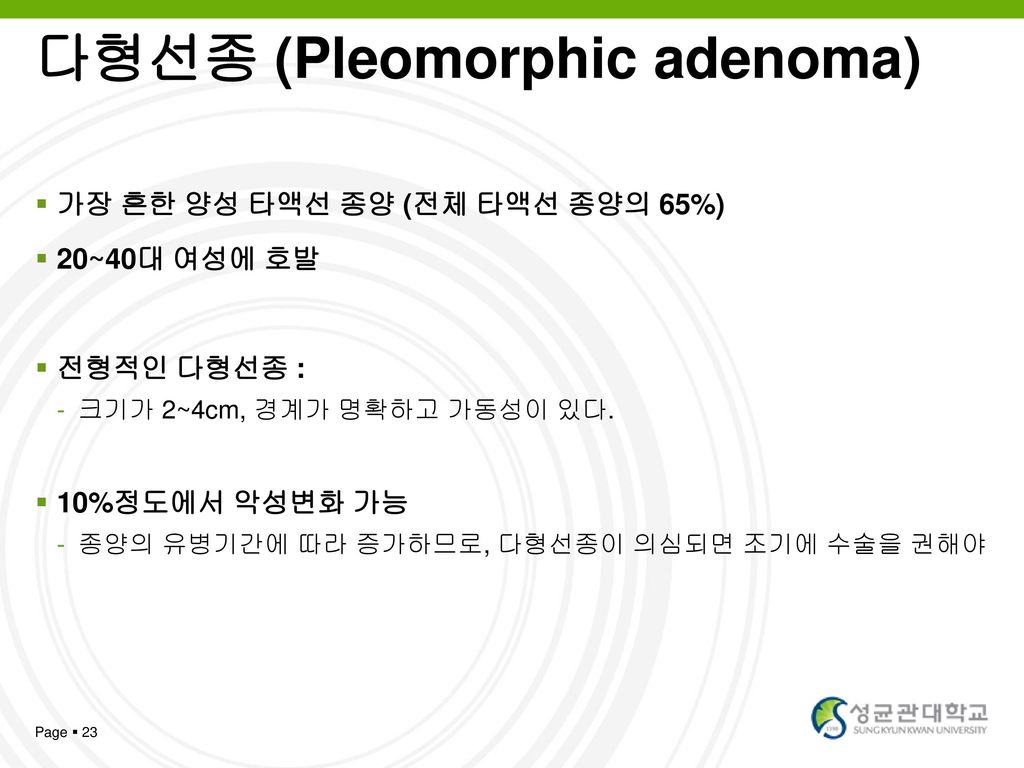 다형선종 (Pleomorphic adenoma)
