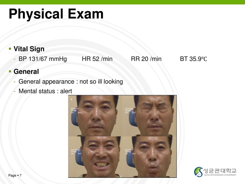 Physical Exam Vital Sign General