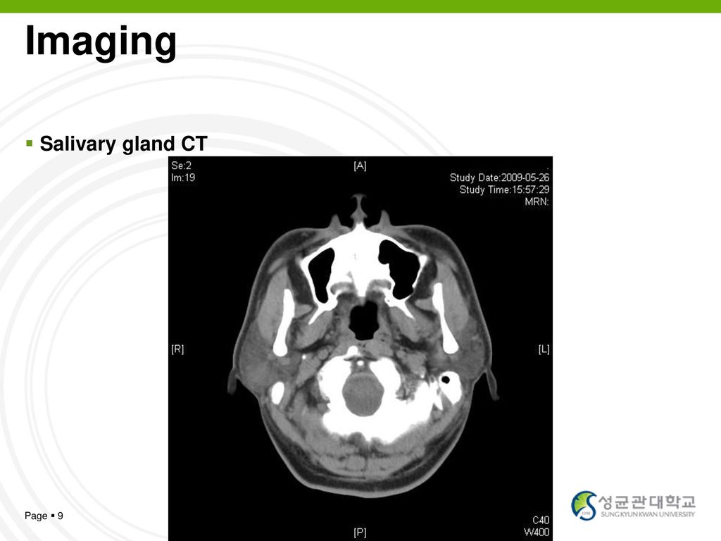 Imaging Salivary gland CT Page  9