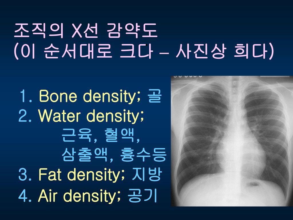조직의 X선 감약도 . (이 순서대로 크다 – 사진상 희다) 1. Bone density; 골 2. Water density;