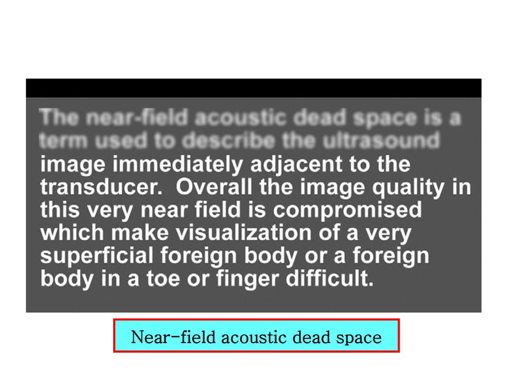 Near-field acoustic dead space