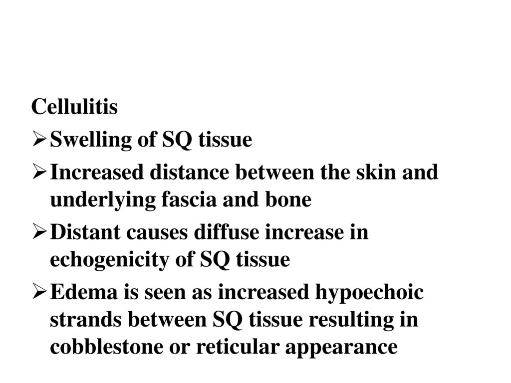 Cellulitis Swelling of SQ tissue. Increased distance between the skin and underlying fascia and bone.