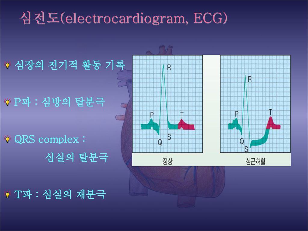 심전도(electrocardiogram, ECG)