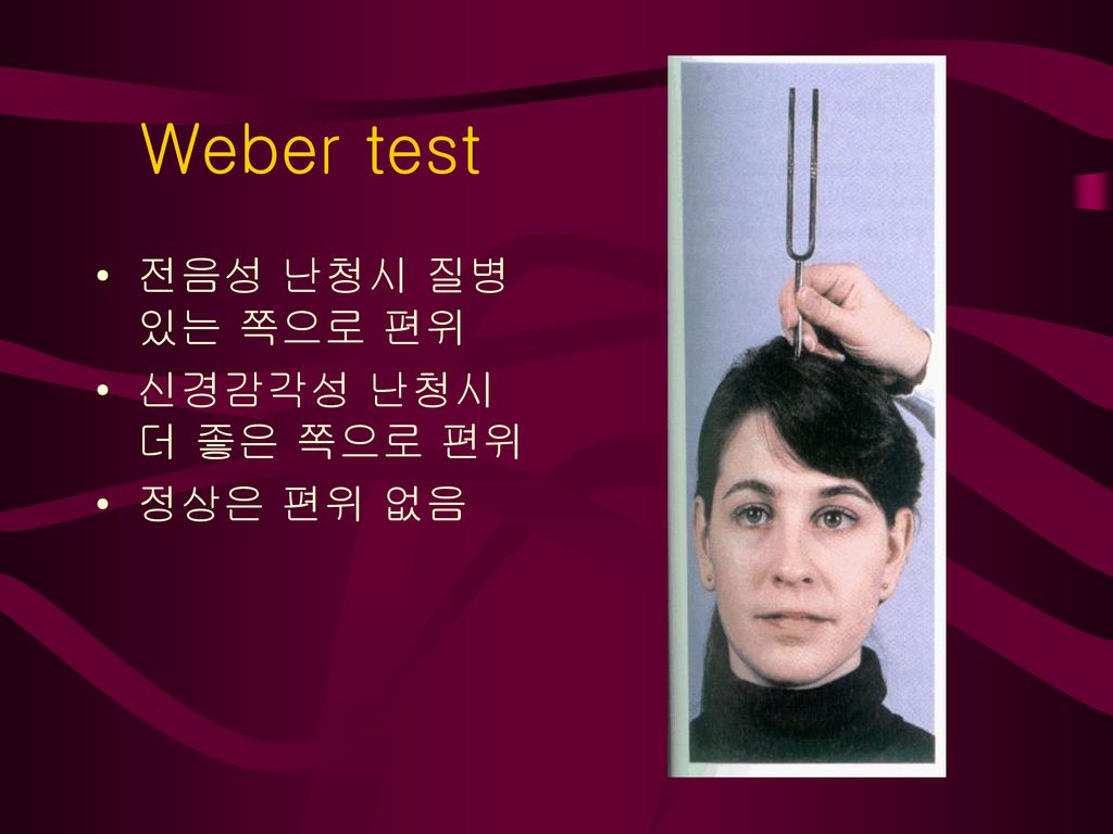 Weber test 전음성 난청시 질병 있는 쪽으로 편위 신경감각성 난청시 더 좋은 쪽으로 편위 정상은 편위 없음