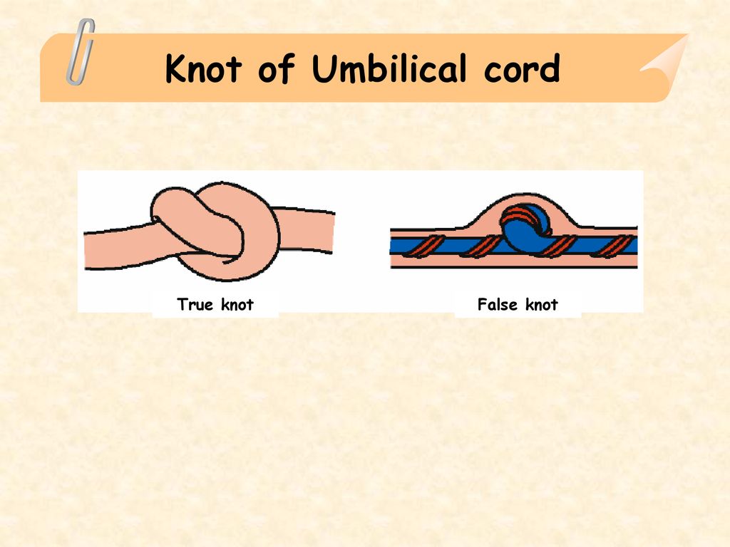 Knotting Compilation