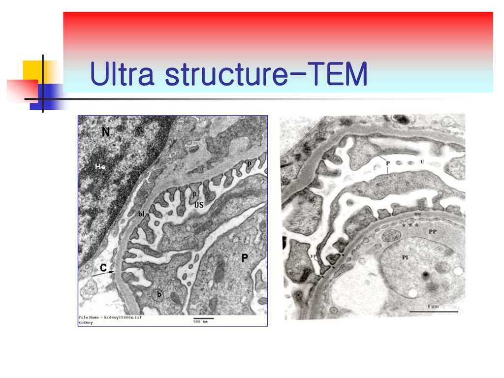 Ultra structure-TEM
