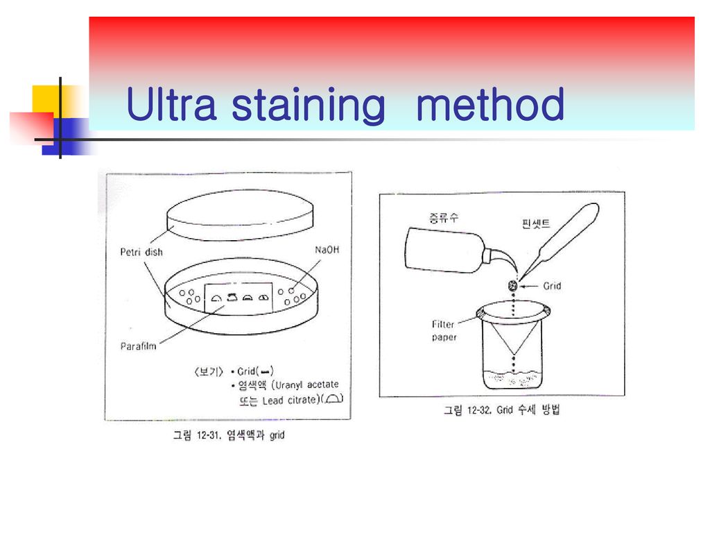 Ultra staining method