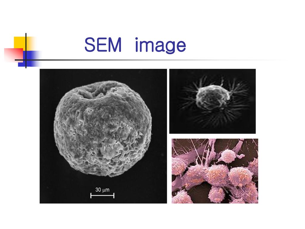 SEM image Breast Cancer Cell /Prostate cancer cells