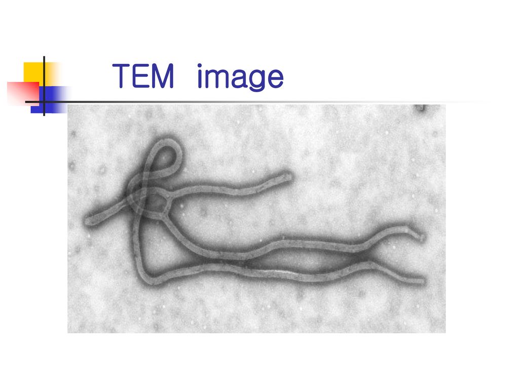 TEM image Ebola Virus