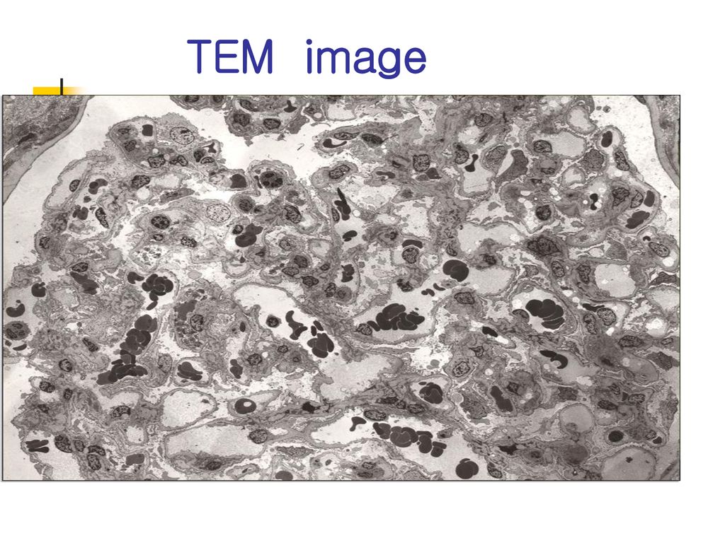 TEM image Glomerolus (kidney