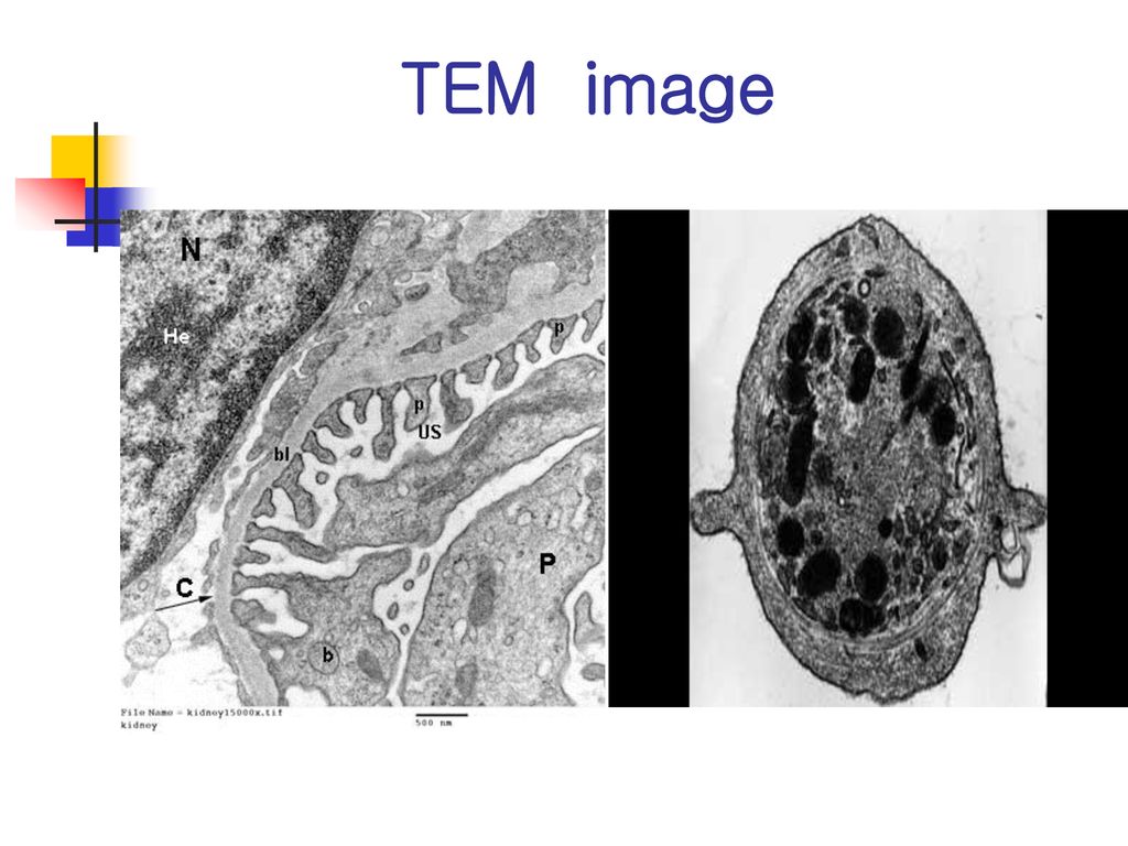 TEM image mitochondria overlaid by