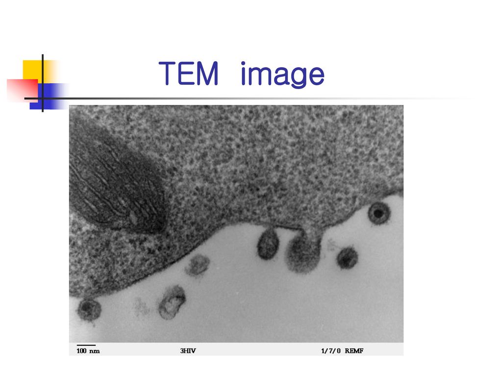 TEM image Mammalian HIV TEM