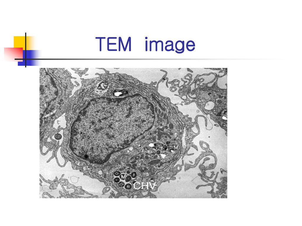 TEM image Mycobacterium tuberculosis