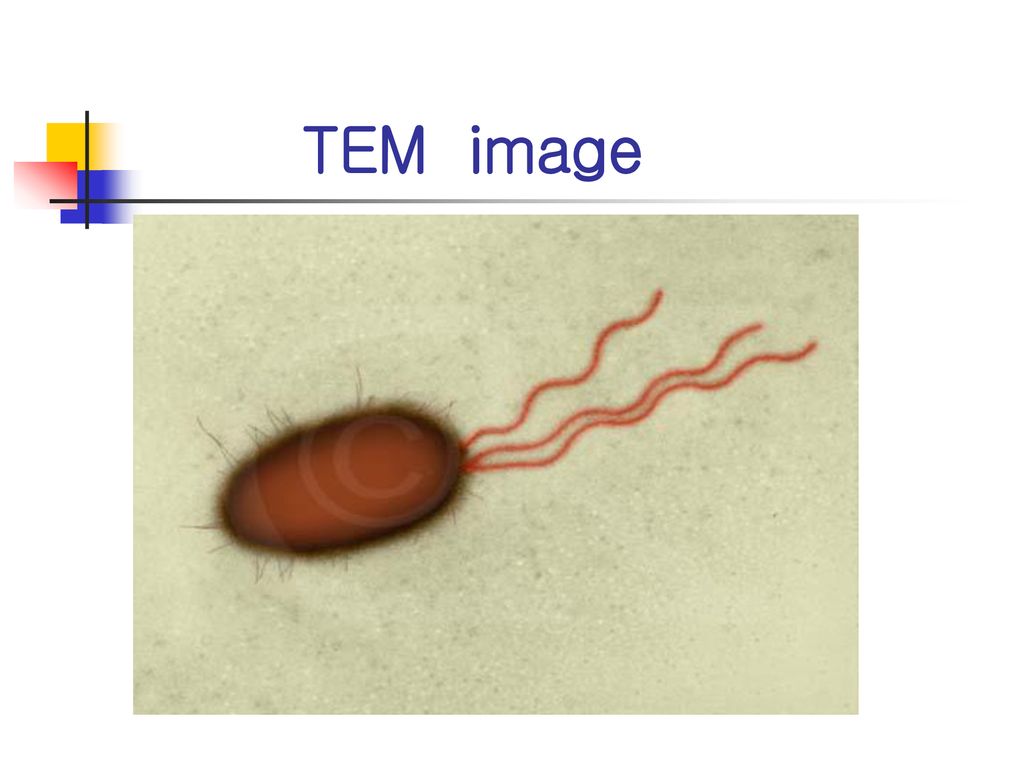 TEM image E. coli (TEM x26,730).