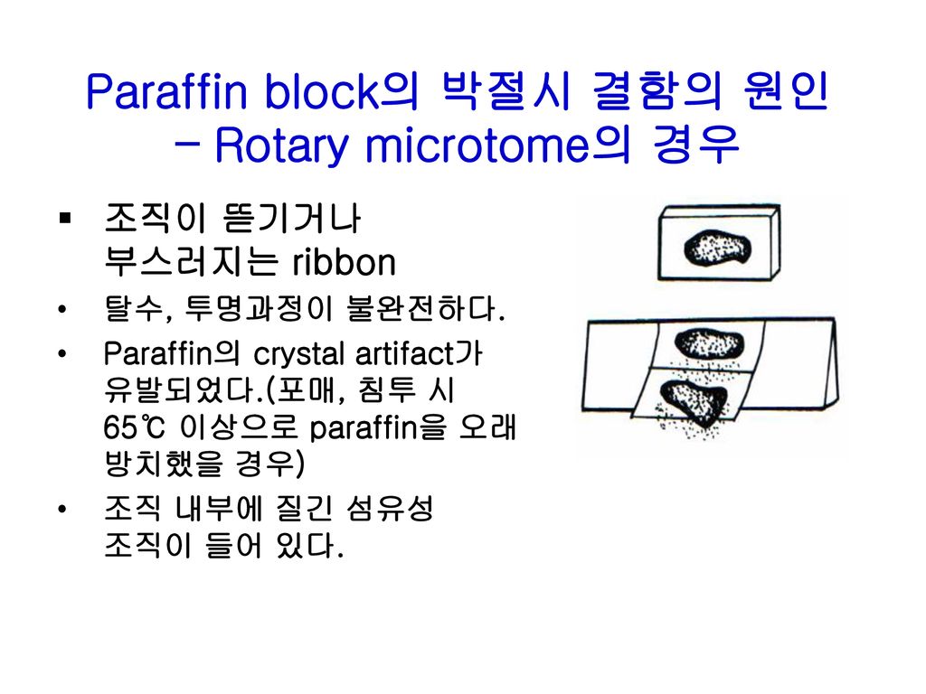 Paraffin block의 박절시 결함의 원인 – Rotary microtome의 경우