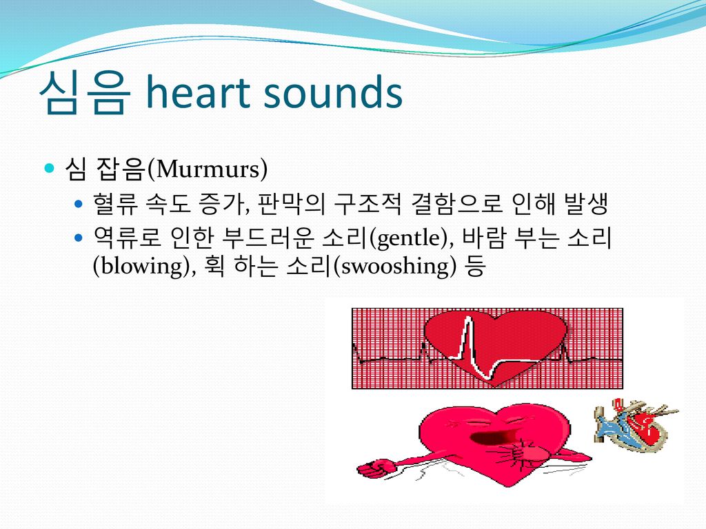 심음 heart sounds 심 잡음(Murmurs) 혈류 속도 증가, 판막의 구조적 결함으로 인해 발생